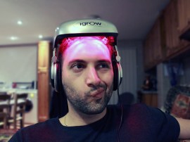 I’m using a laser-firing helmet to regrow my hair – part 1